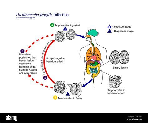  Marita! Un Parassita Intestinale che Può Farvi Sentire un Po' a Disagio ma con una Vita Incredibilmente Complicata