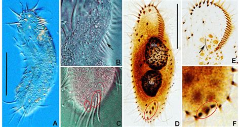  Oxytricha! A Microscopic Marvel That Defies Simplicity