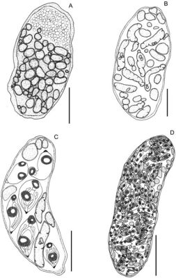  Proctoeces Maculatus: Un Parassita Clandestino che Conduce una Vita Segreta nel Cuore dei Pesci!