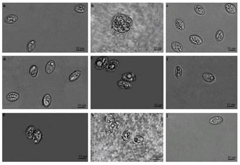 Sarcocystis! Un Parassita Intrinsecamente Connesso al Ciclo Vita di Molteplici Animali Ospiti