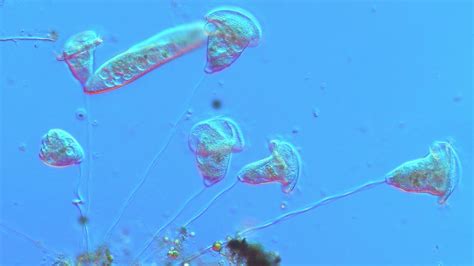  Vorticella! Una piccola creatura con tentacoli che puliscono l’acqua come una spazzola di precisione